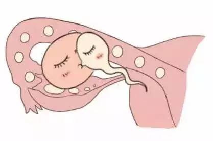 正规供卵代生子